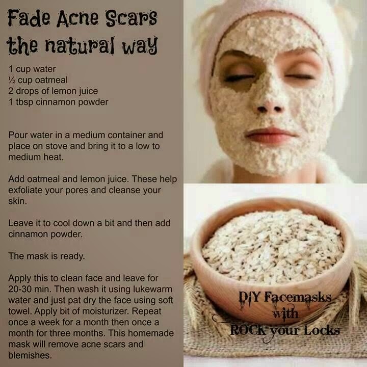 Get Rid Of Scars Naturally IAmJeni